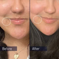 PanOxyl Acne Foaming Wash Benzoyl Peroxide 10% Maximum Strength – Image 3