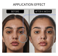 PanOxyl Acne Foaming Wash Benzoyl Peroxide 10% Maximum Strength – Image 6