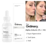 THE ORDINARY - Alpha Arbutine 2% + HA 30ml – Image 4
