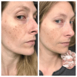 THE ORDINARY - HYALURONIC ACID 2% + B5 - Full Size 60ml – Image 9