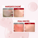 SOME BY MI - SNAIL TRUECICA MIRACLE REPAIR SERUM - 50ml – Image 5