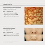 SOME BY MI - YUJA Niacin Anti-Blemish Cream - 60g – Image 8