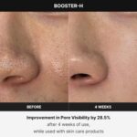 MEDICUBE - AGE-R Booster Pro - Appareil de soin visage – Image 6