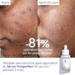 CAUDALIE - New Vinoperfect  Sérum Éclat Anti-Taches - 30ml – Image 15