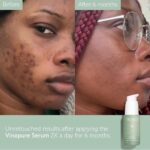 CAUDALIE - Vinopure Sérum salicylique anti-imperfections - 30ml – Image 10