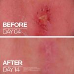 LA ROCHE-POSAY - Cicaplast Baume B5+ - 40ml – Image 11