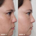 PAULA'S CHOICE - MINI Skin Perfecting 2% BHA Lotion Exfoliante - 30 ml – Image 5