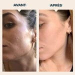 PAULA'S CHOICE - MINI Skin Perfecting 2% BHA Lotion Exfoliante - 30 ml – Image 7