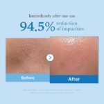 MEDICUBE - Zero Pore Blackhead Deep Cleansing Oil - 205ml – Image 2