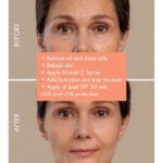 MARUDERM - Vitamine C & Peptide Sérum éclaircissant pour La Peau - 30ml – Image 7