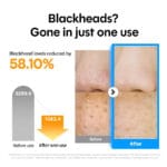 MANYO - Pure Cleansing Oil - 200ml – Image 6