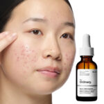THE ORDINARY - Aloe 2% + NAG 2% Solution- 30ml – Image 2