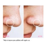 MARUDERM - BHA Post-Minimisant & Anti-Acné Tonifiante - 250ml – Image 5