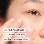 THE ORDINARY - Aloe 2% + NAG 2% Solution- 30ml – Image 3