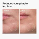 THE ORDINARY - Sulfur 10% Powder-to-Cream Concentrate – Image 4