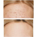 SOME BY MI - AHA BHA PHA 30 DAYS MIRACLE CREAM - 60g – Image 5