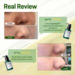 SOME BY MI - Bye Blackhead Miracle Green Tea 120g – Image 15