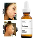 THE ORDINARY - MANDELIC ACID 10% + HA – Image 4