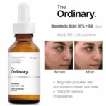 THE ORDINARY - MANDELIC ACID 10% + HA – Image 5